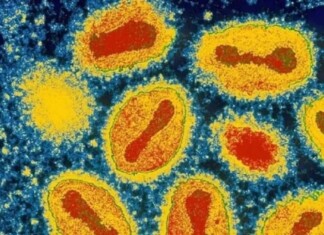 Amazonas contabiliza 33 casos confirmados de Mpox e 103 notificações totais