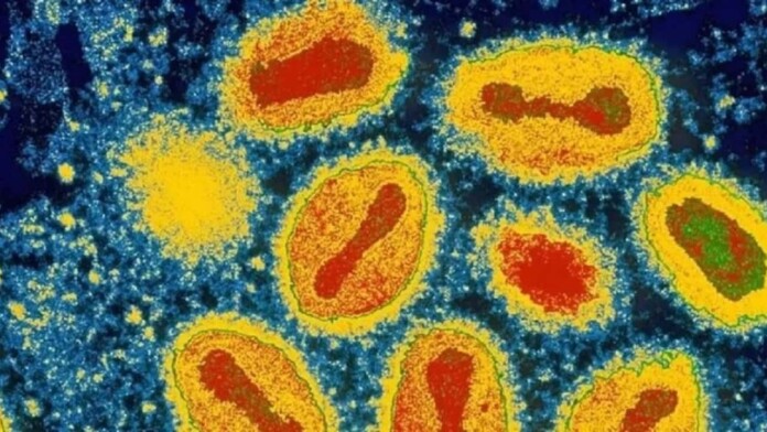 variola-dos-macacos-monkeypox-niaid-1