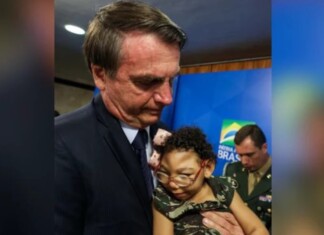 Microcefalia: Bolsonaro critica veto de Lula à pensão vitalícia