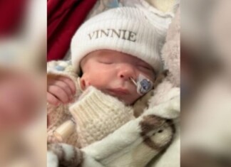 Bebê surpreende pais ao nascer com orelha na bochecha e sem olho direito