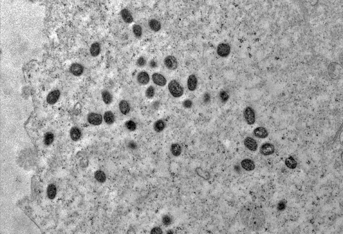 monkeypox_02