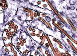 Gripe aviária faz primeira vítima humana na América Latina, aponta autoridade mexicana