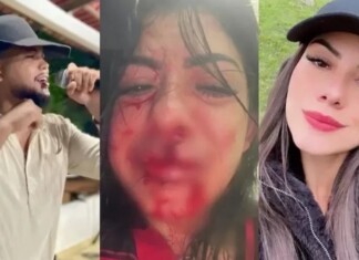 Após ser espancada e ter os dentes quebrados, ex-companheira retira a queixa contra cantor de Manaus