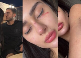 VÍDEO: Miss Grand Amazonas denuncia agressões físicas e ameaças de morte do ex-namorado