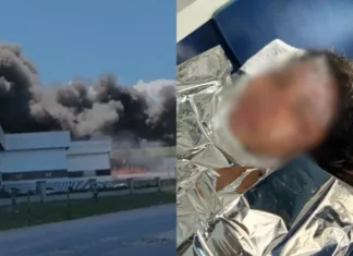 Jovem grávida é hospitalizada após ser atingida por chamas em incêndio na Effa Motors