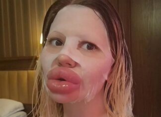 Mulher gasta R$ 140 mil em cirurgias estéticas e afirma: “Beleza natural é entediante”