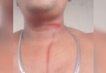 Acidente com linha de papagaio deixa jovem ferido na zona sul de Manaus