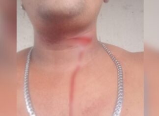 Acidente com linha de papagaio deixa jovem ferido na zona sul de Manaus