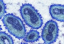 Porto Alegre registra novo caso de Mpox e reforça alerta para o carnaval