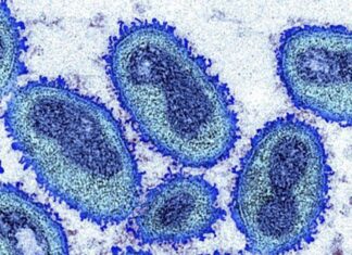 Porto Alegre registra novo caso de Mpox e reforça alerta para o carnaval