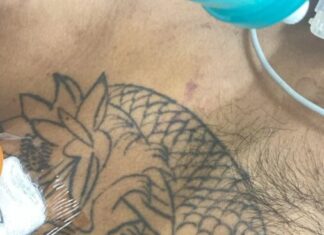 Hospital João Lúcio pede ajuda para identificar paciente em estado gravíssimo com base em tatuagens