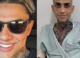 Morre Jota Surfista, influenciador que lutava contra câncer e cirrose hepática