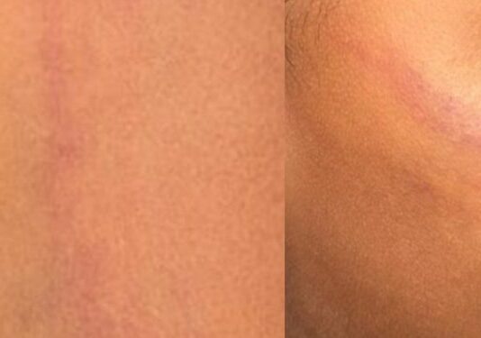 Mãe é investigada após agredir filho com corda e arrancar dente da criança no Amazonas