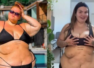 Thais Carla comemora 1 ano de bariátrica com 100 kg a menos