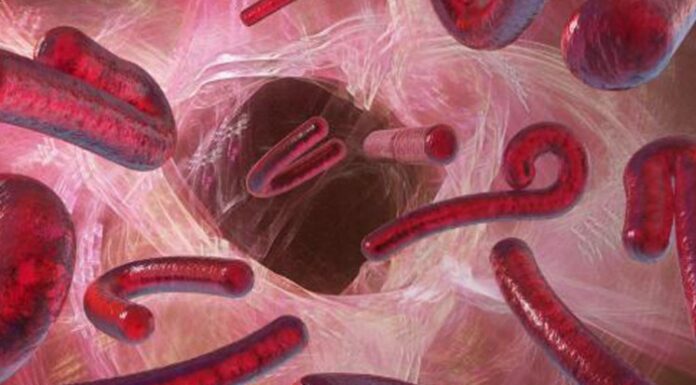 Novo surto de Ebola leva Organização Mundial da Saúde a decretar emergência global na África