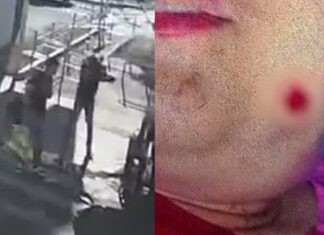 Suspeito aborda jovem, questiona atitude e dispara contra ela