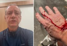 Apresentador da Globo é ferido por pitbull e faz alerta sobre segurança com animais