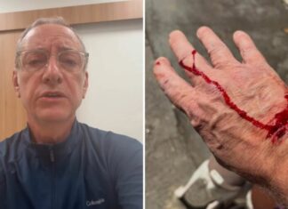 Apresentador da Globo é ferido por pitbull e faz alerta sobre segurança com animais