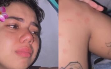 Influenciadora Thayane volta a repercutir após ataque de carapanãs em trilha no Monte Roraima