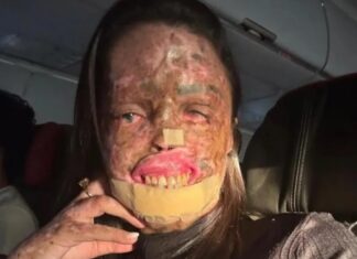 Morre Karine Felipe, influencer que lutava contra doença rara