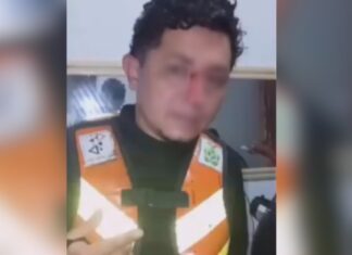 Mototaxista fica ferido após linha de papagaio cortar seu rosto em município do Amazonas