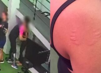 Professora denuncia instrutor após ser agarrada e mordida durante treino
