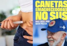 Lula promete canetas emagrecedoras no SUS, mas medida depende de três etapas