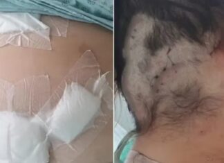 Mulher é mantida em cárcere, t0rturada e atingid@ pelo ex com 12 facad@s: ‘fingi que estava m0rta’